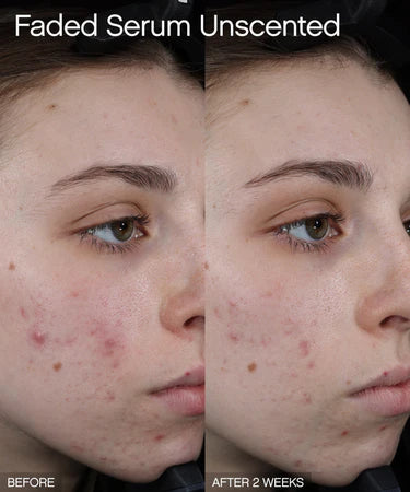 Topicals Faded Brightening and Clearing Serum